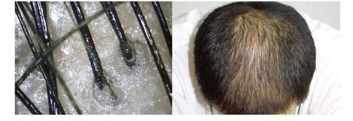 茶氏家族-山茶籽調(diào)理精油 茶氏家族-山茶籽調(diào)理精油